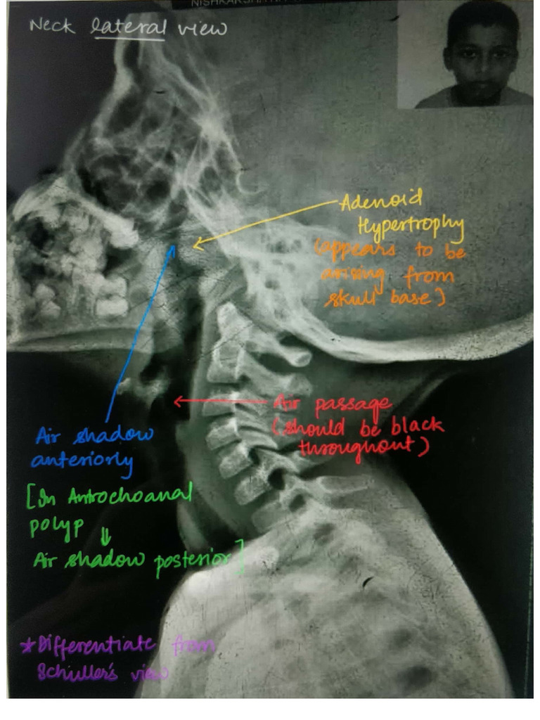 Ent Xray | PDF