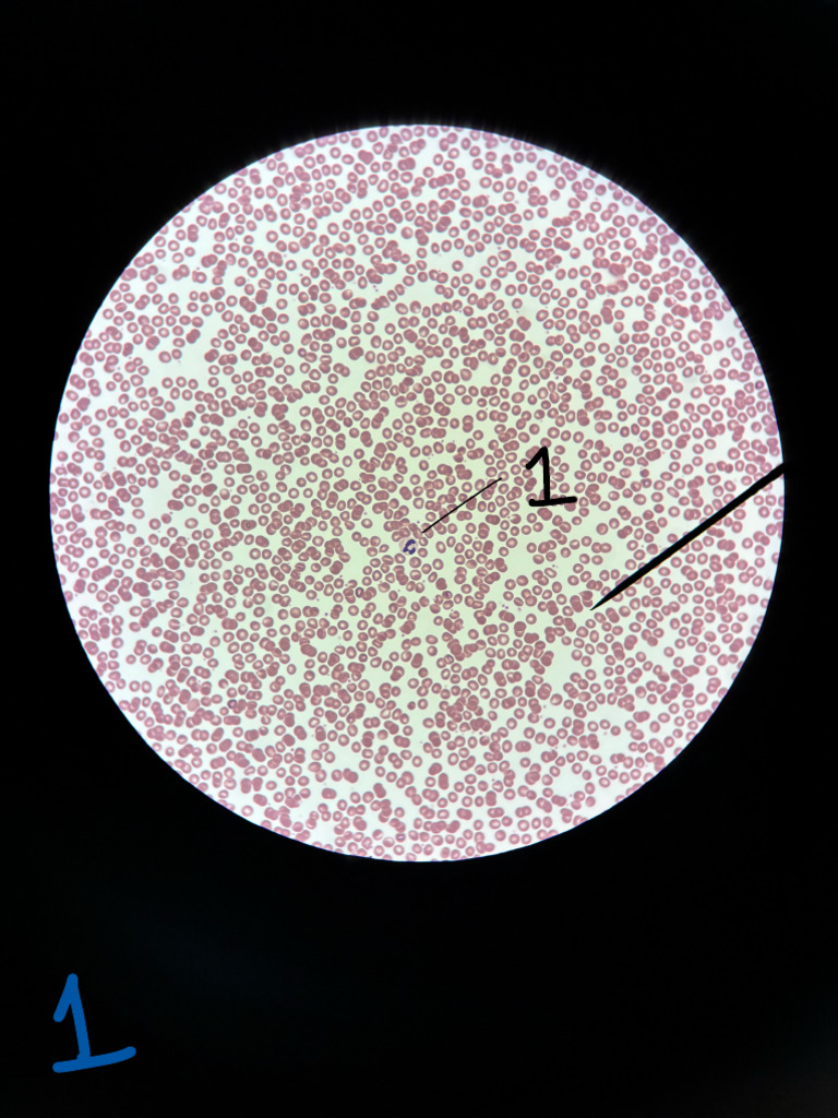 Blood ID | PDF