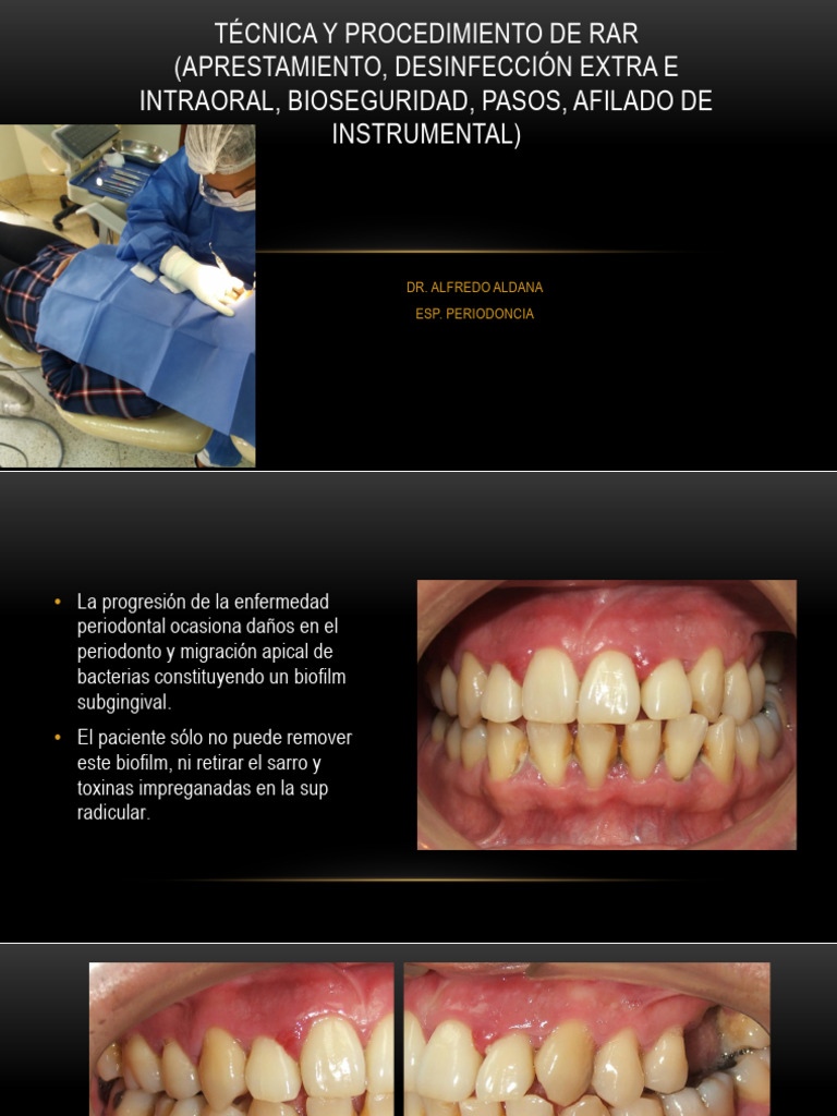 Procedimiento Rar | PDF | Odontología | Ciencias de la Salud