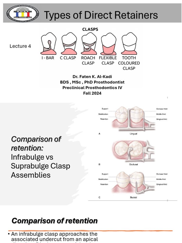 L4.Types of Direct Reainer | PDF | Mouth | Dentistry
