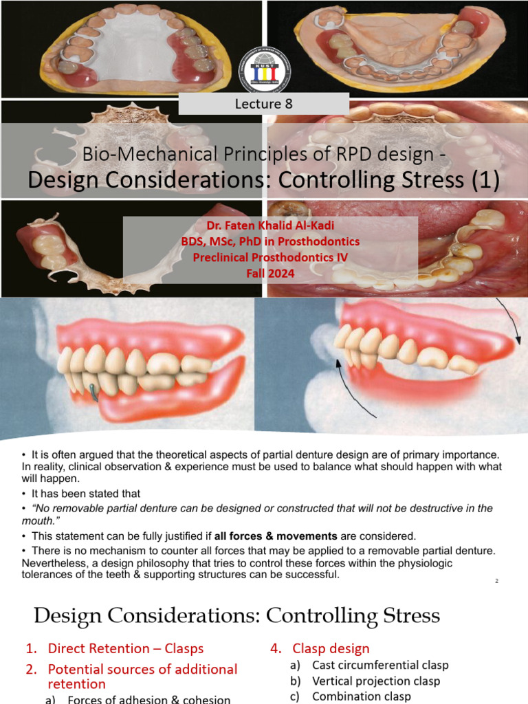 8 Principles of Removable Partial Dentures Design Part 1 | PDF | Dental ...