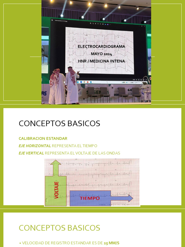 Electrocardiograma MAYO 2024 HNR / Medicina Intena | PDF