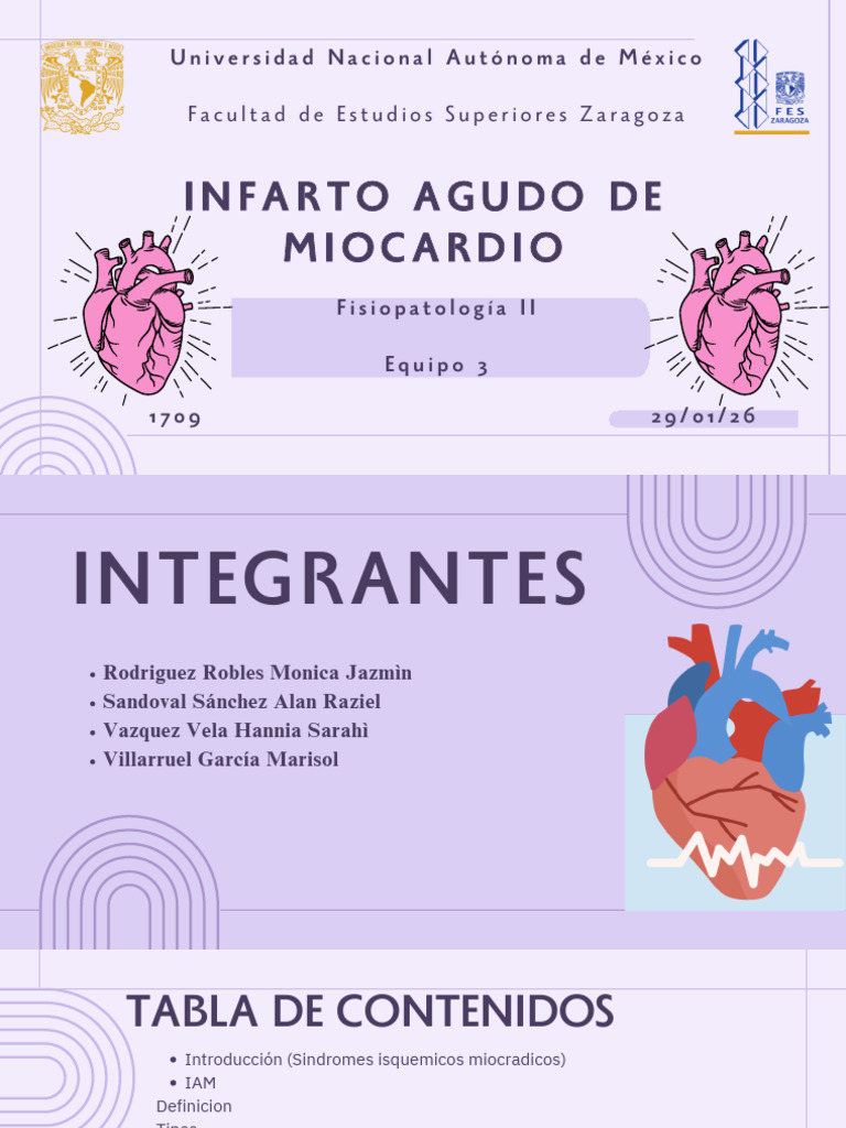 Infarto Agudo de Miocardio 20260129 151445 0000 | PDF | Infarto de ...