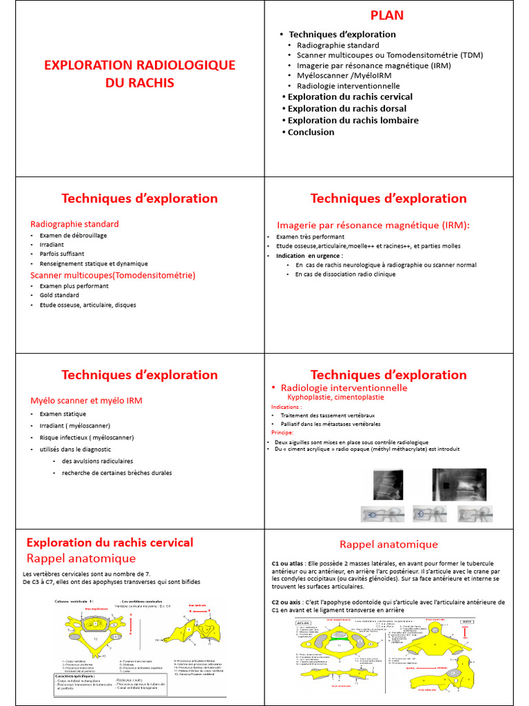 2-Exploration Radiologique Du Rachis S1clinique | PDF | Vertèbre ...