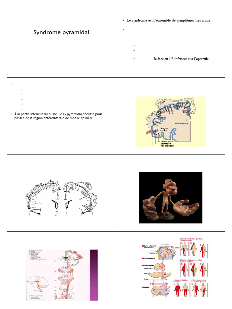 06 - Syndrome Pyramidal | PDF | Pied | Nerf