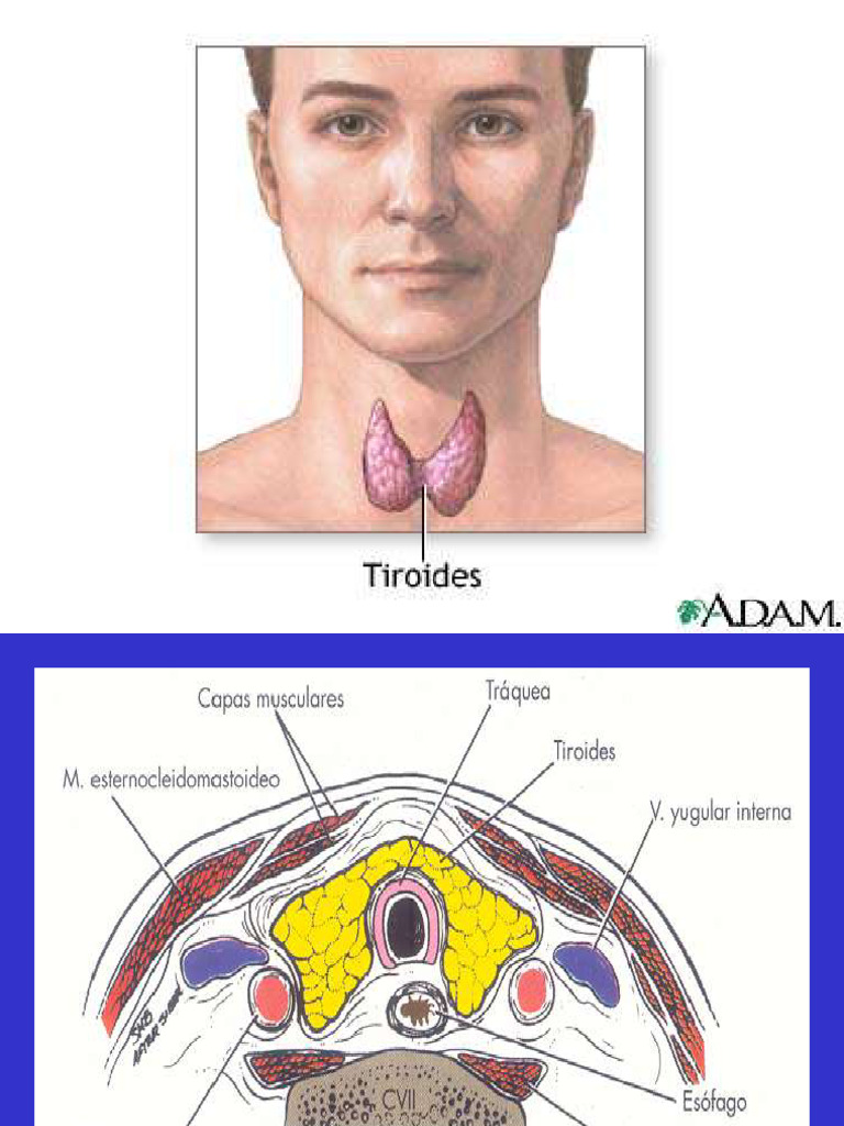 Tiroides, A | PDF | Tiroides | Oncología