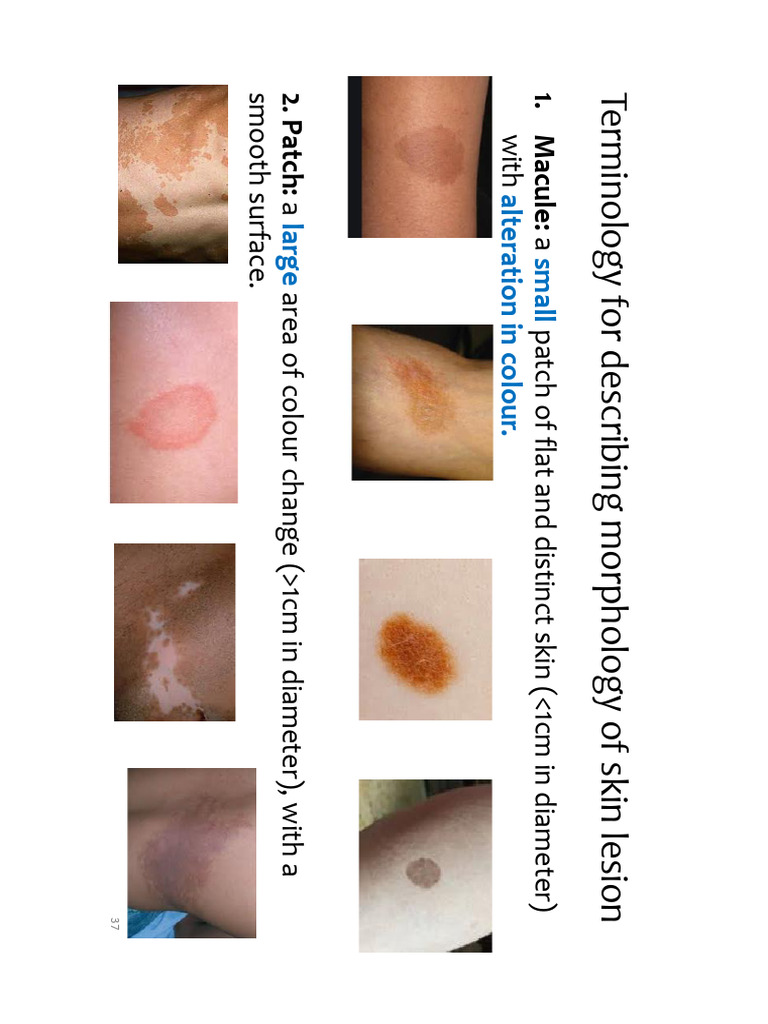 1 Dermatological Assessment and Common Diagnostic Tests - 11 Jan 2 | PDF