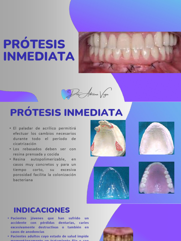 Prótesis Inmediata | PDF | Odontología | Especialidades Medicas