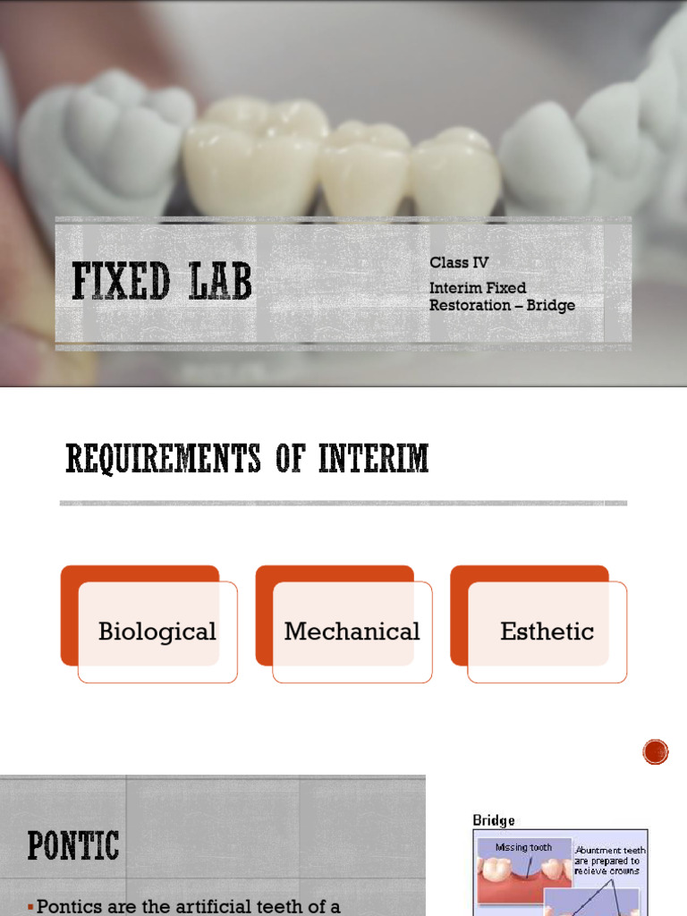 No.4 Interim - Bridge | PDF