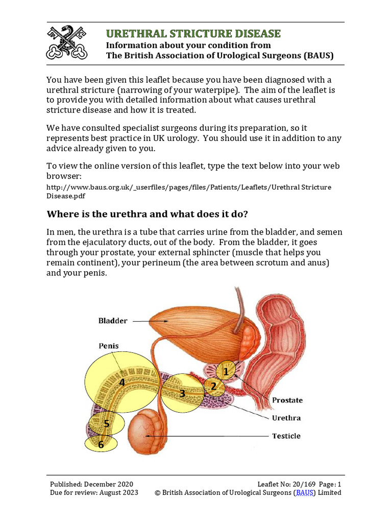 Urethral Stricture Disease | PDF | Urinary System | Genitourinary System