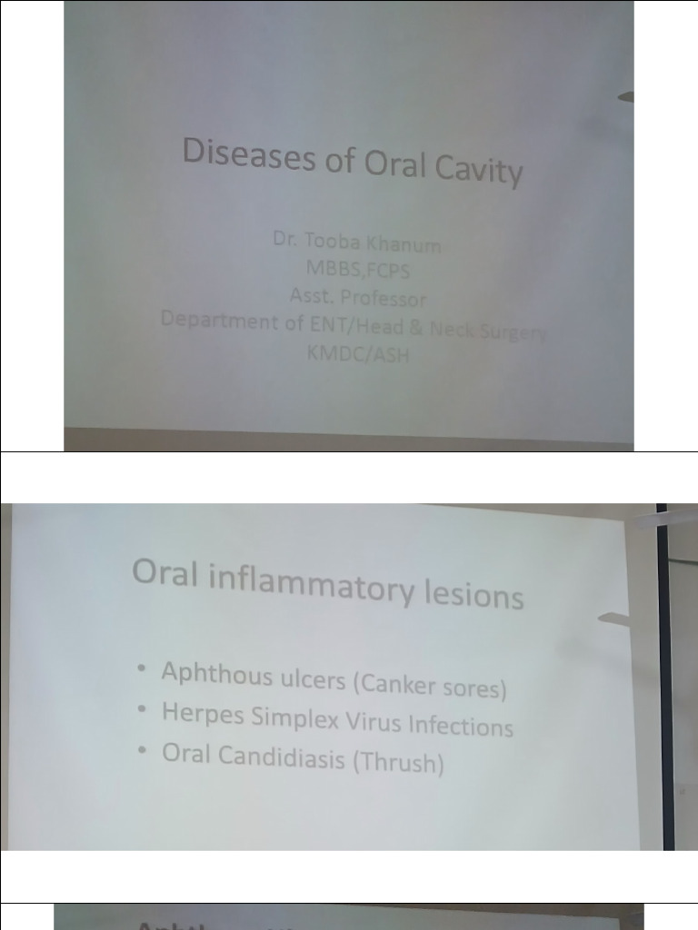 Diseases of Oral Cavity | PDF