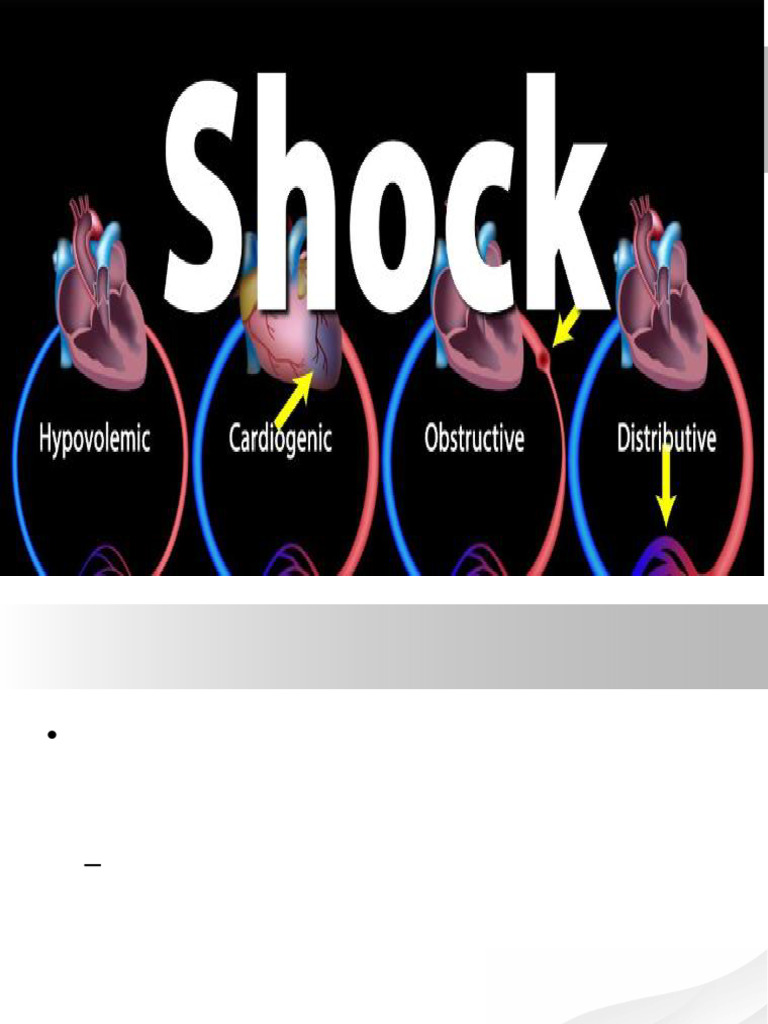 L20 - Shock - Dr Neoh Kar Keong | PDF | Shock (Circulatory) | Heart