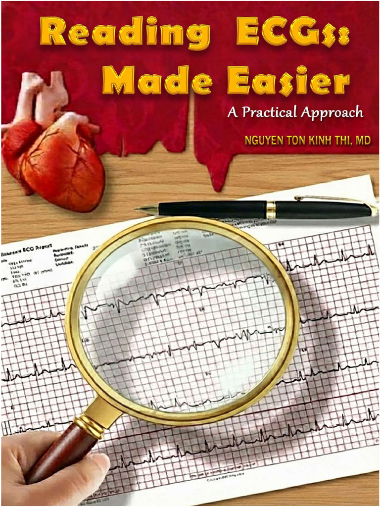 Reading ECGs Made Easier Print | PDF | Electrocardiography | Myocardial ...