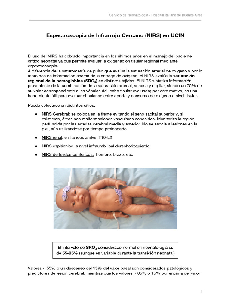 NIRS 2022 | PDF | Cerebro | Vena