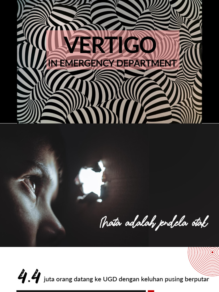 Pemeriksaan Vertigo | PDF | Vertigo | Diseases And Disorders