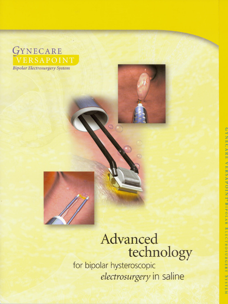 Versapoint Brochure | PDF