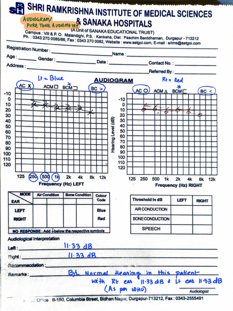 Audiogram Solved | PDF