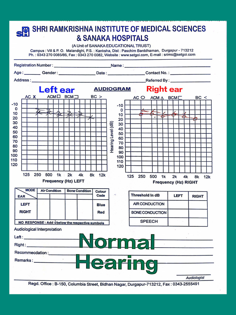 Audiogram, EnT, OSCE | PDF