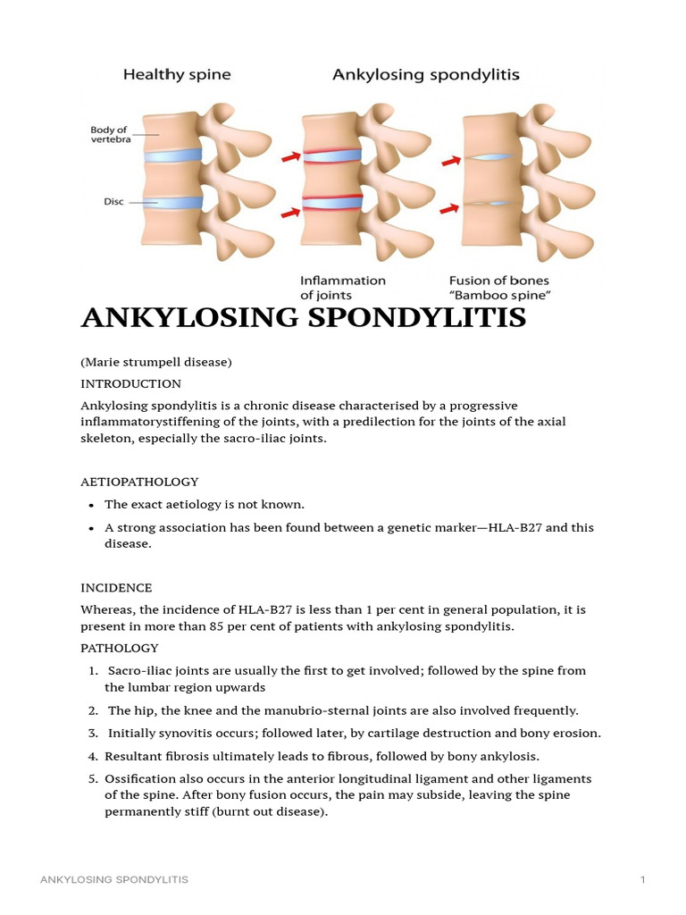 Ankylosing Spondylitis 3 | PDF | Pelvis | Medical Specialties