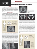 Dicas de Radiologia Convencional No Quadril
