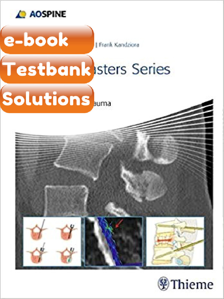 Testbank AOSpine Masters Series Volume 6 Thoracolumbar Spine Trauma by ...