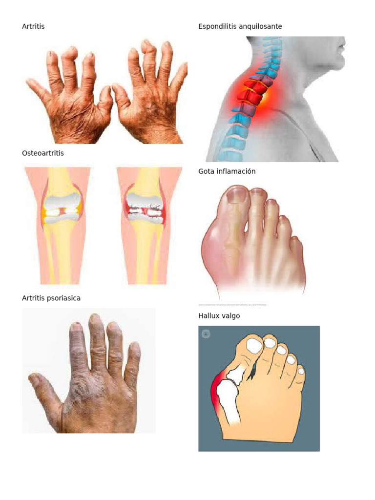 Art Ritis | PDF