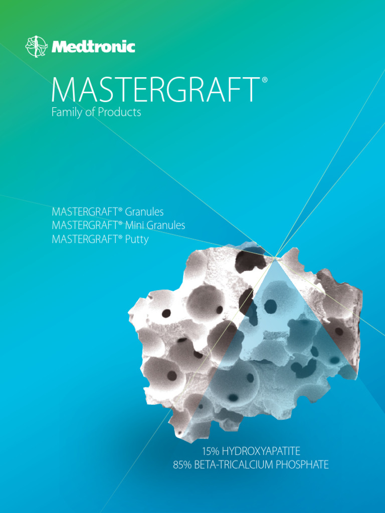 MASTERGRAFT - Family of Products | PDF | Dental Implant | Bone