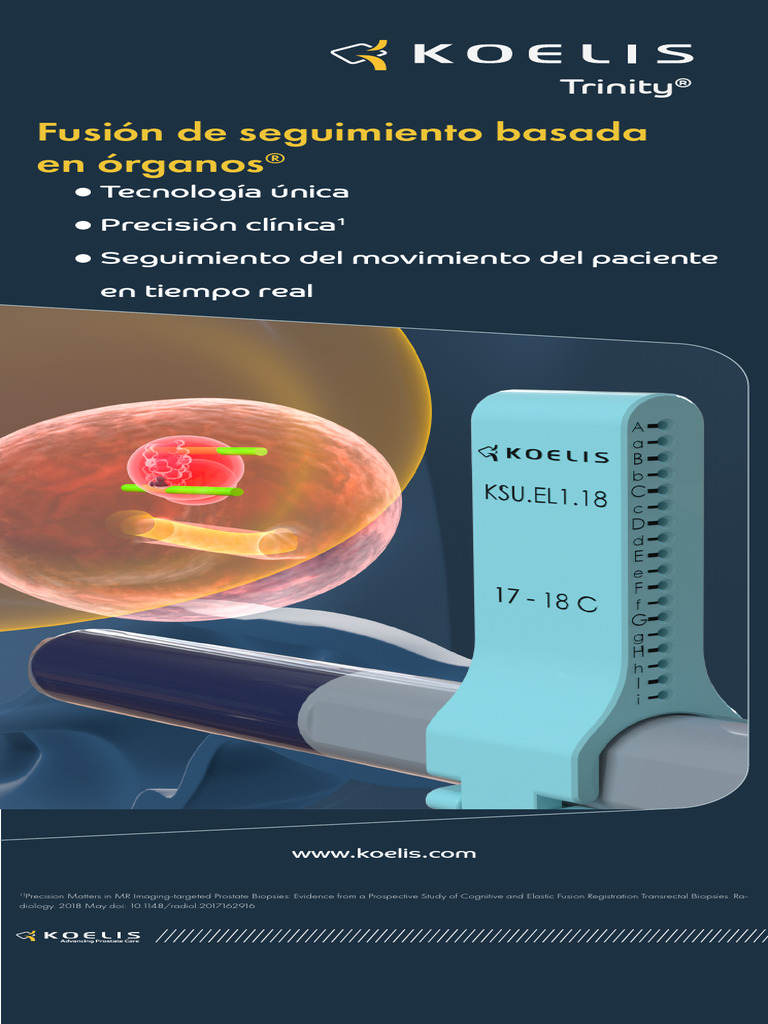 KOELIS Roll-Up OBT Chili | PDF