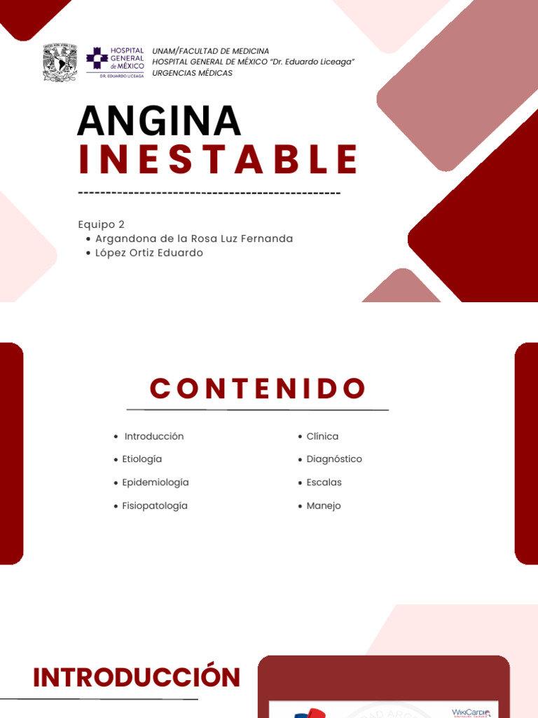 Angina Inestable - Equipo2 | PDF | Infarto de miocardio | Sistema ...