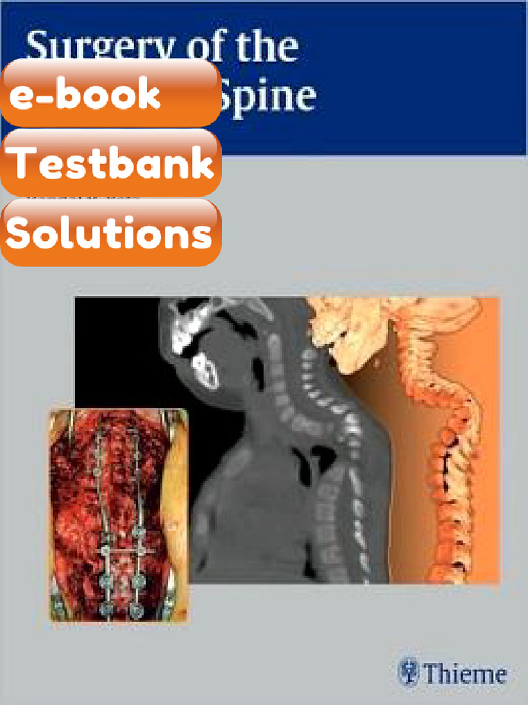 Testbank Surgery of the Pediatric Spine Fast Download | PDF ...