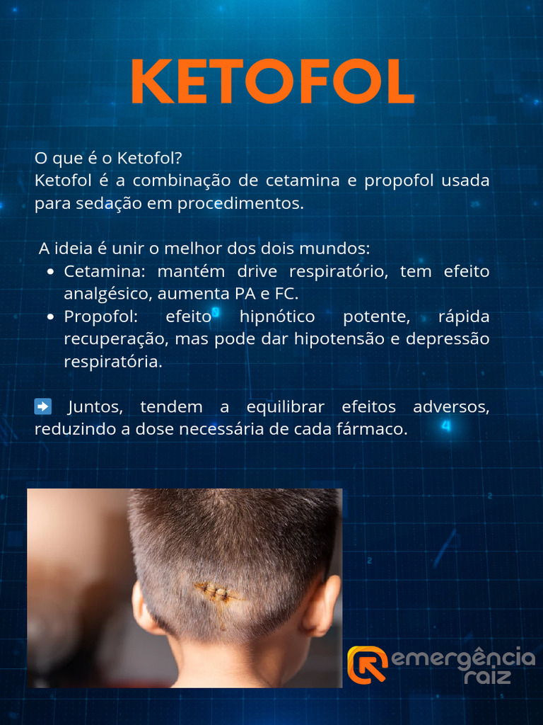 Ebook Ketofol | PDF