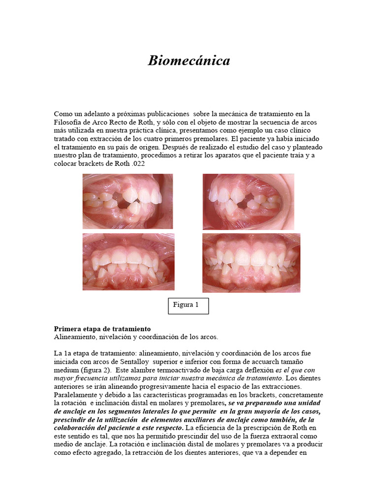 Filosofía de Roth Biomecánica | PDF | Anatomia dental | Diente