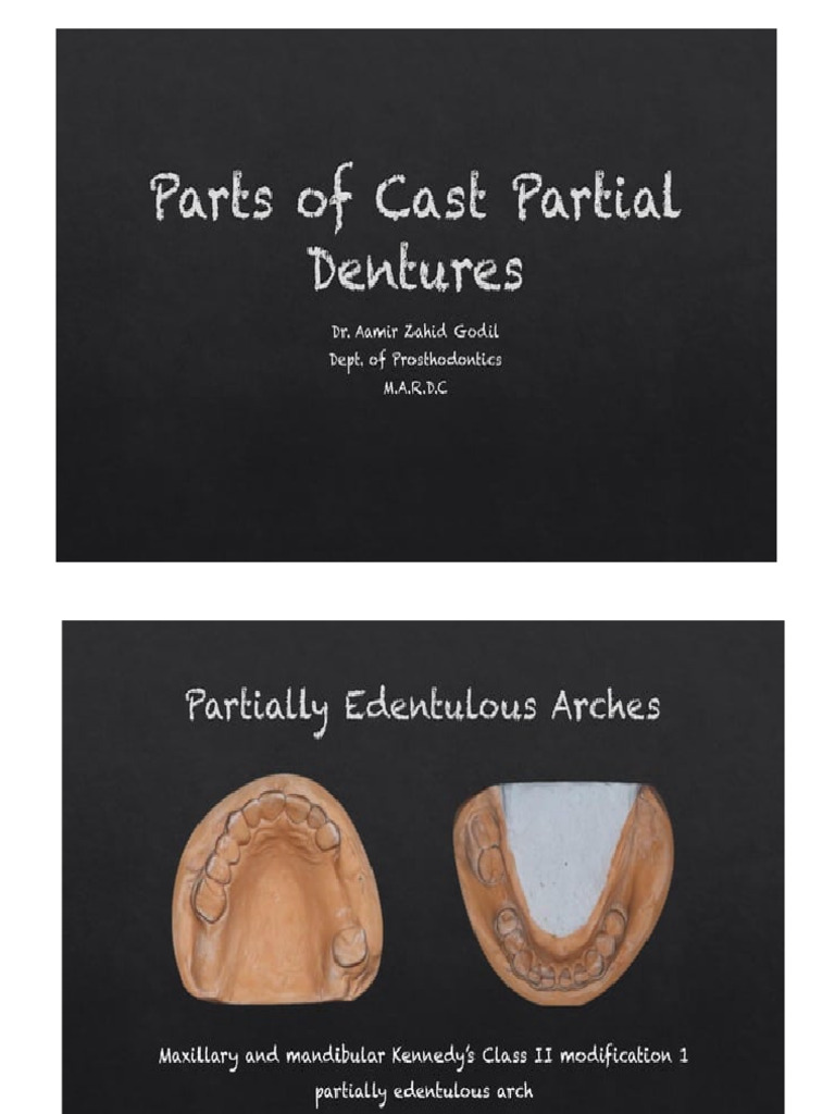 Part of RPD | PDF
