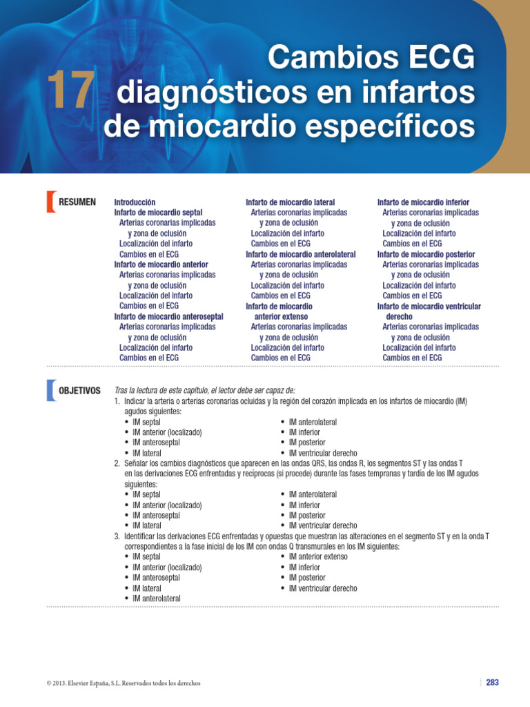 17 Ima | PDF | Infarto de miocardio | Electrofisiologia