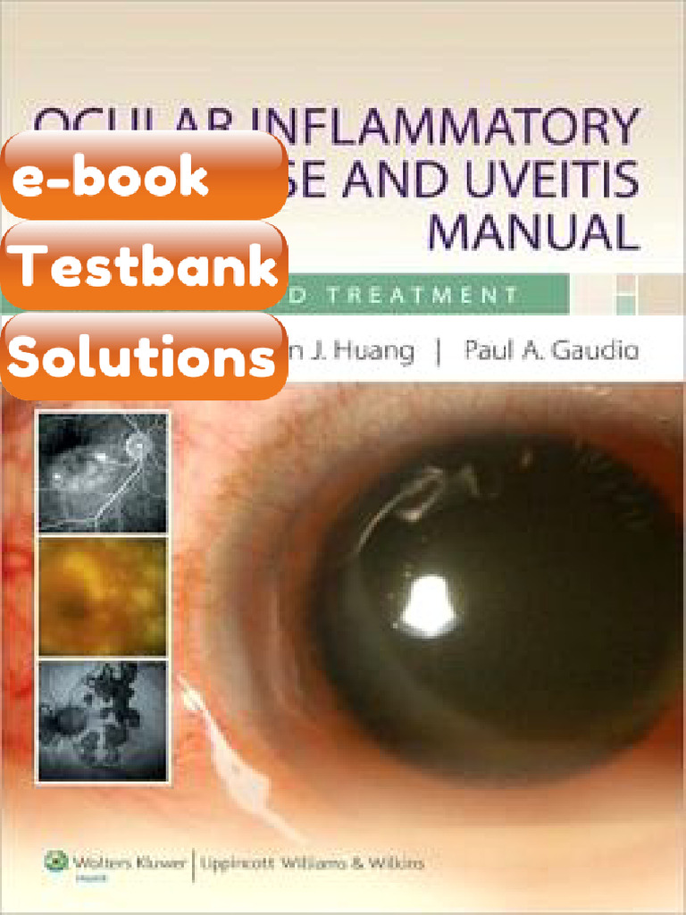 eBook & Testbank Ocular Inflammatory Disease and Uveitis Manual ...