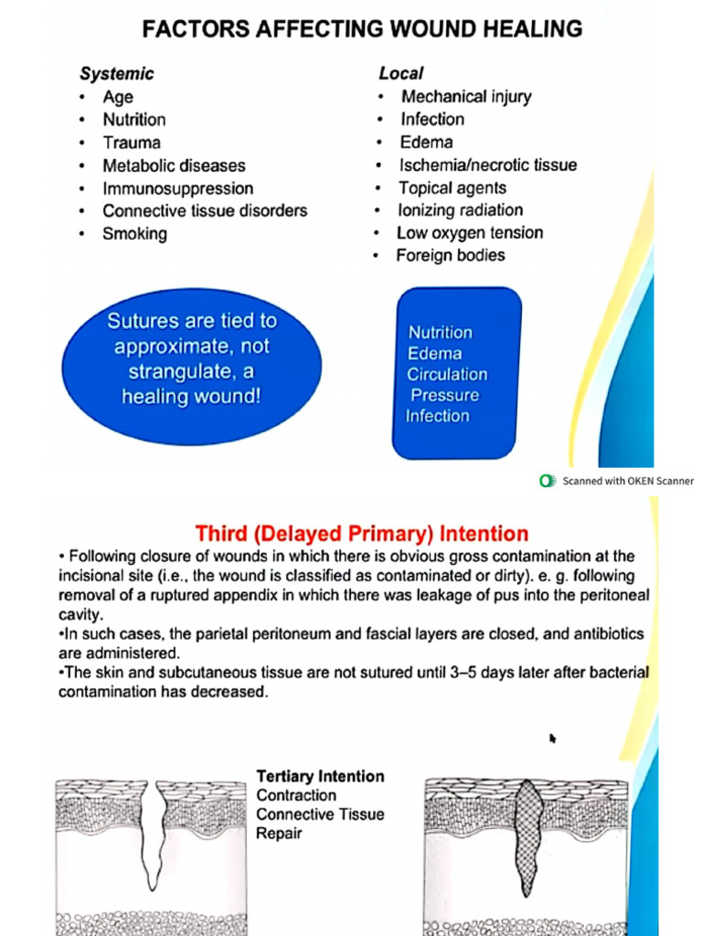 Wound and Wound Healing Surgery | PDF