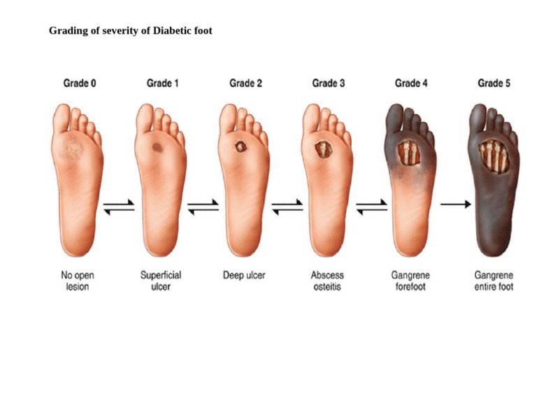 Grading of Severity of Diabetic Foot | PDF
