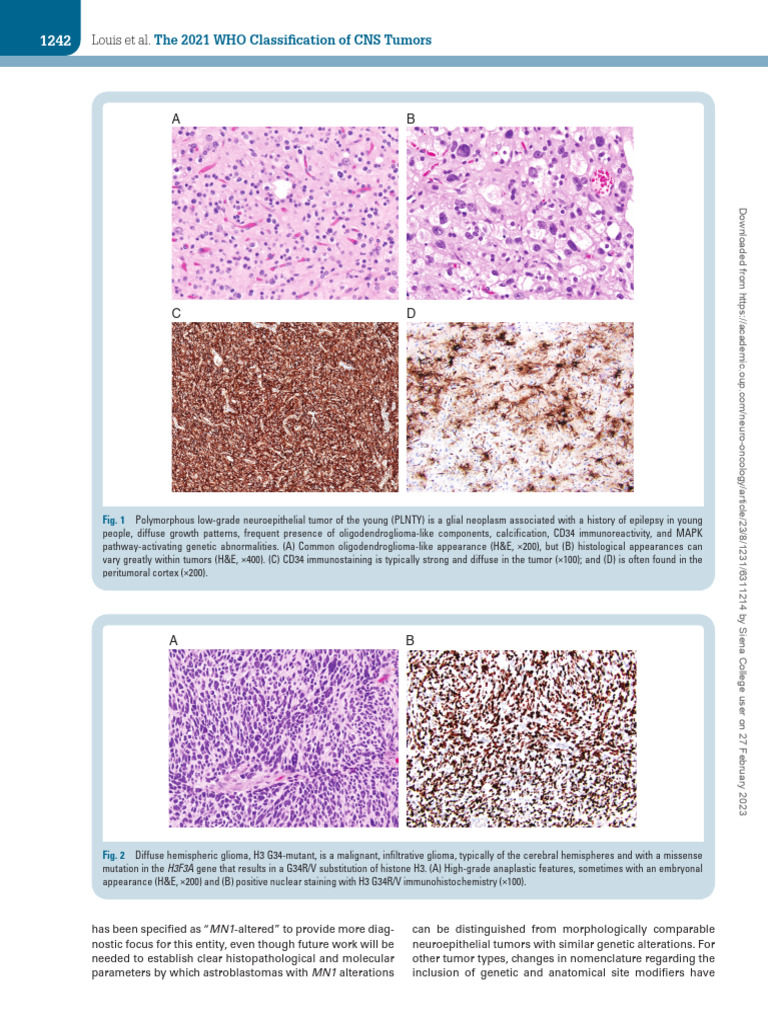 The - 2021 - WHO - Classification - of - Tumors - of - The - Centr 2-12 ...