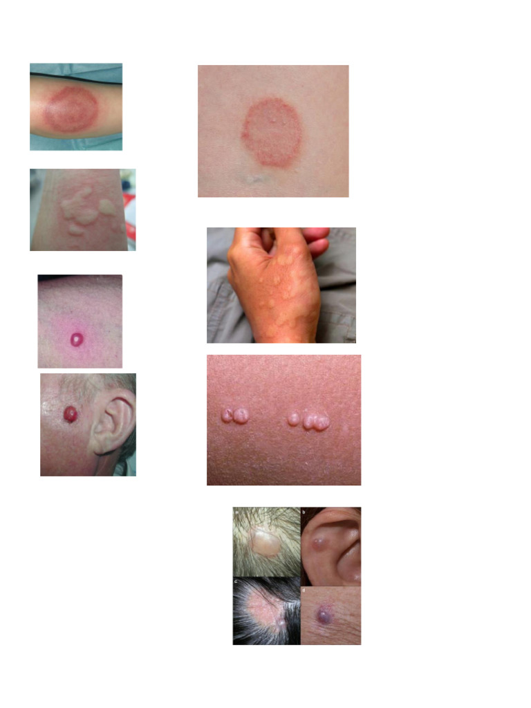 Derma | PDF