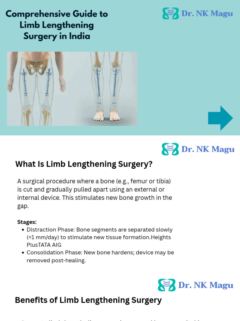 What Is Limb Lengthening Surgery DR N.K Magu | PDF