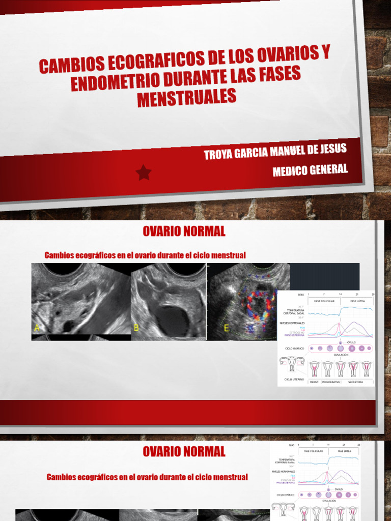 Cambios Ecograficos de Los Ovarios y Endometrio | PDF
