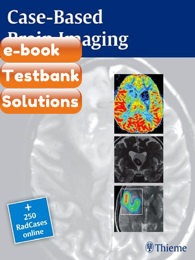 Testbank CaseBased Brain Imaging 2nd Edition Fast Download | PDF ...