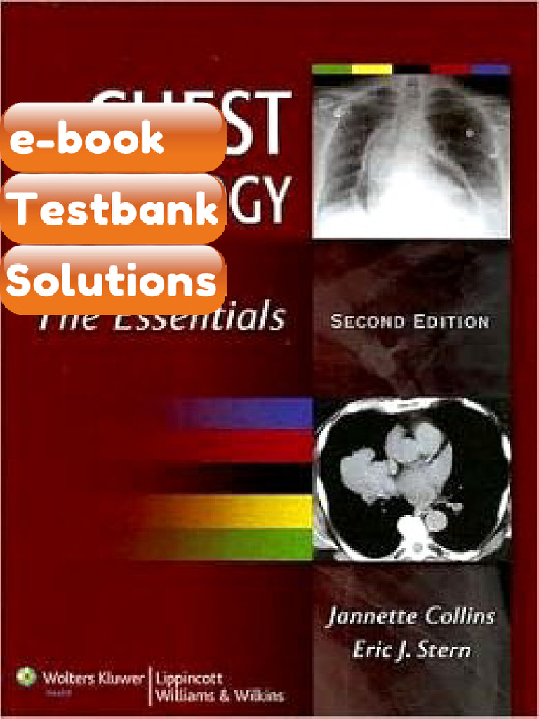 Testbank Chest Radiology the Essentials 2nd Edition Fast Download | PDF ...