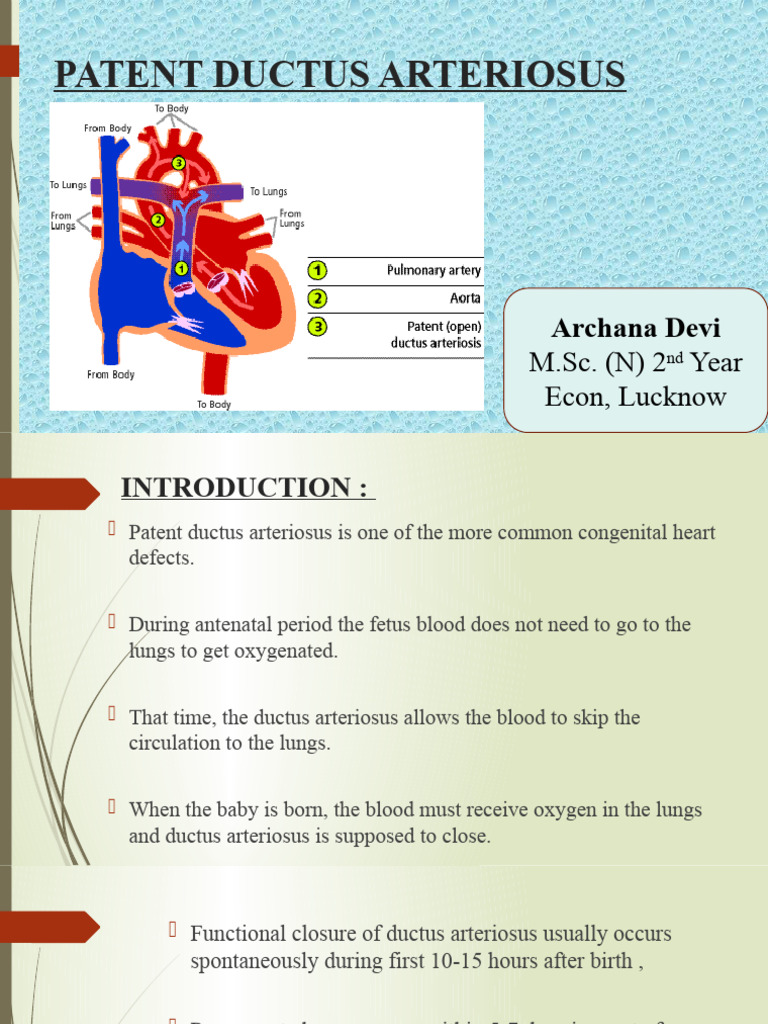 Patent ductus arteriosus | PDF | Fetus | Heart