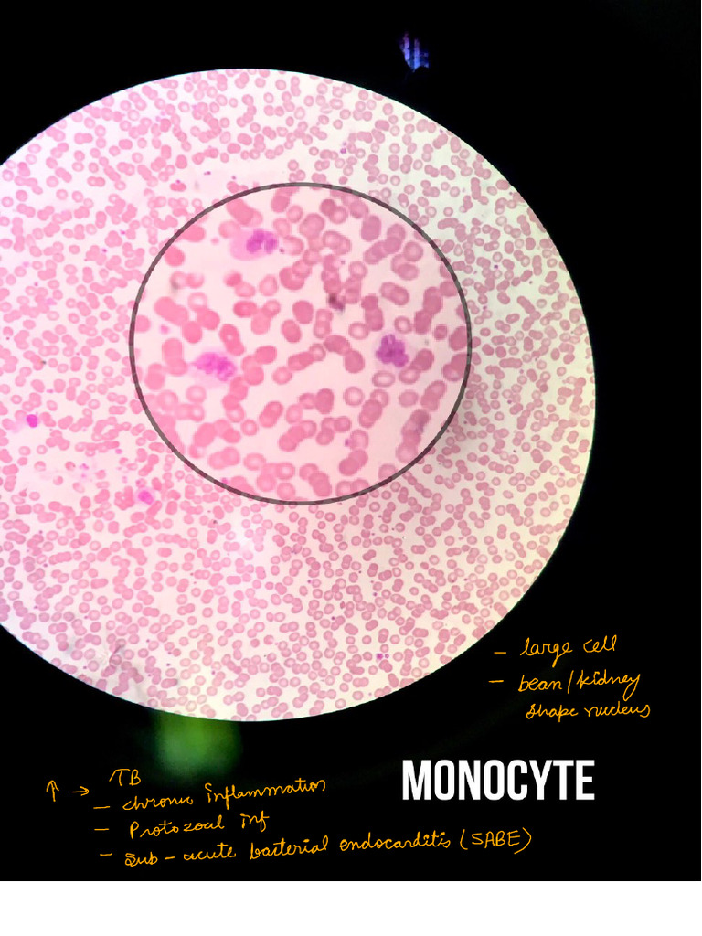 Hematology | PDF