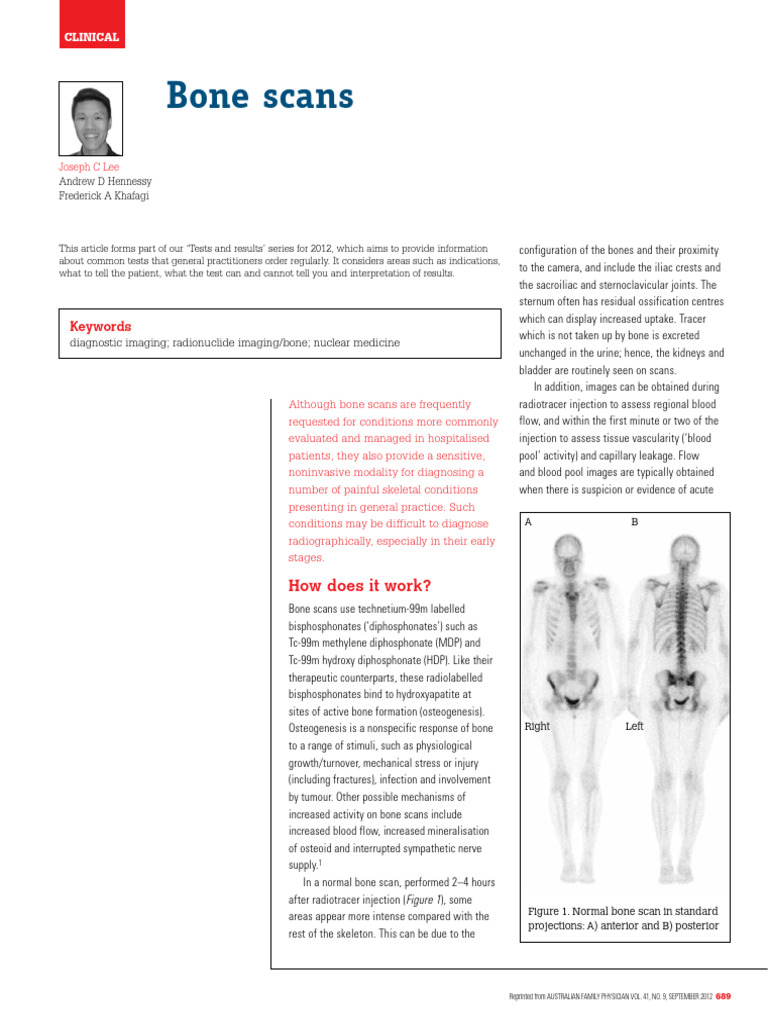 Bone Scans | PDF | Ct Scan | Bone