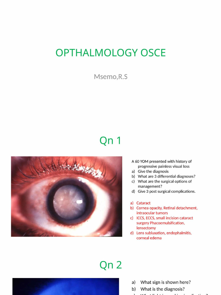 Ophthalmic OSCE | PDF