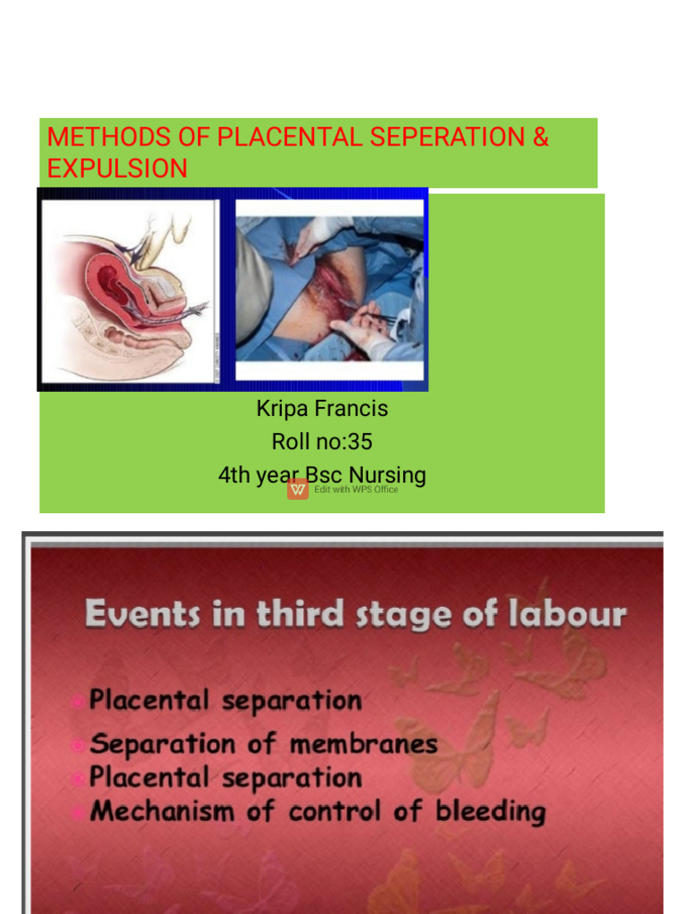 methods of placental separation and expulsion | PDF
