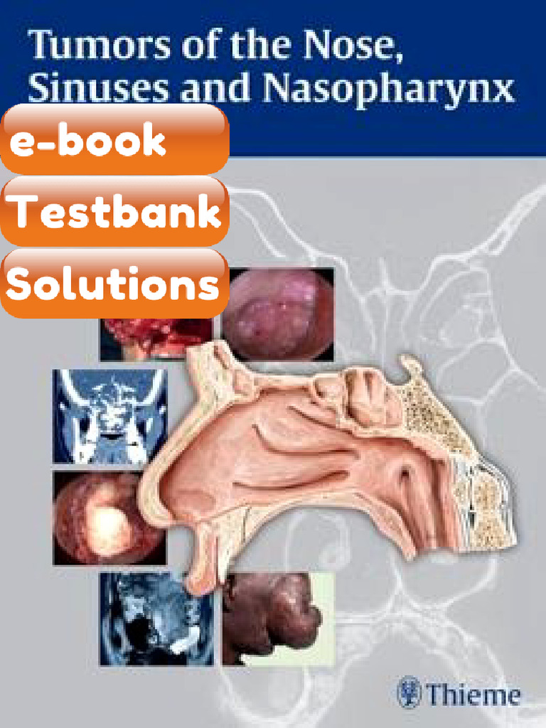 Testbank Tumors of the Nose Sinuses and Nasopharynx Fast Download | PDF ...