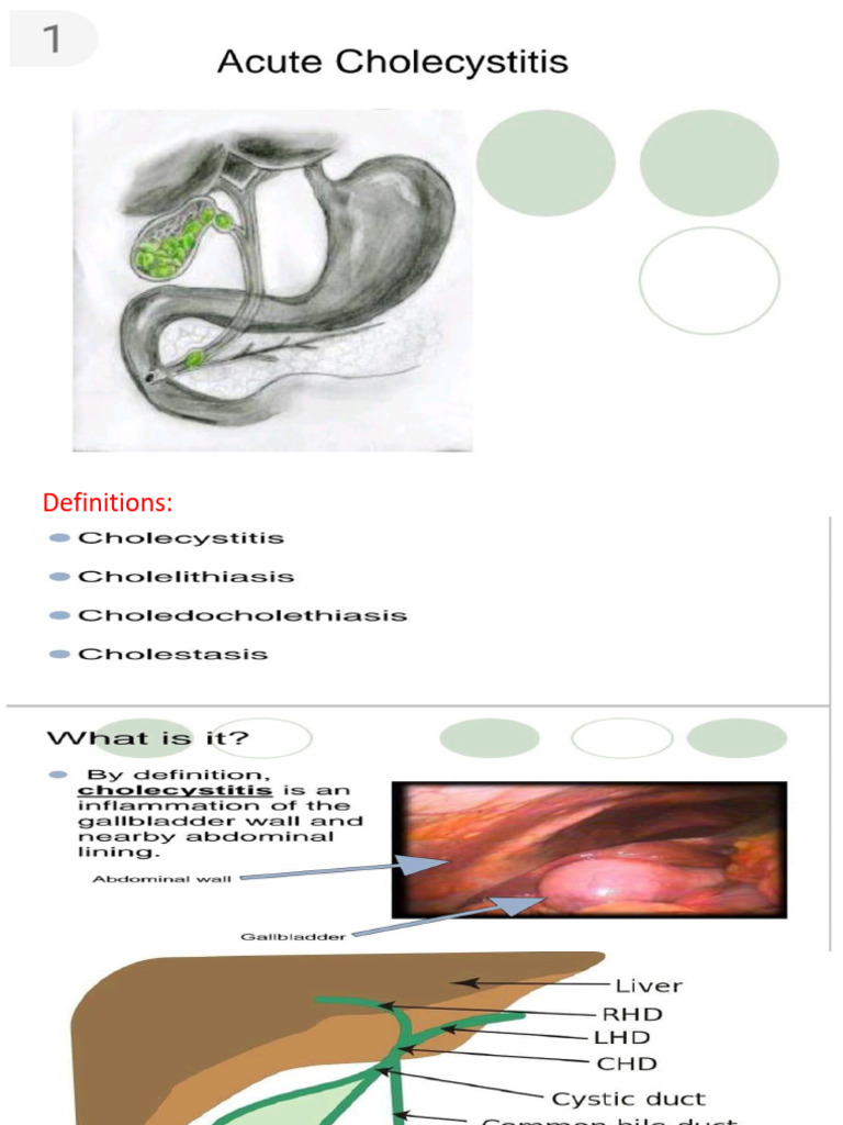Acute Cholecystitis | PDF